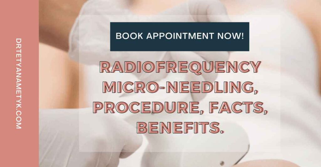 Radiofrequency Micro Needling, Procedure, Facts, Benefits.