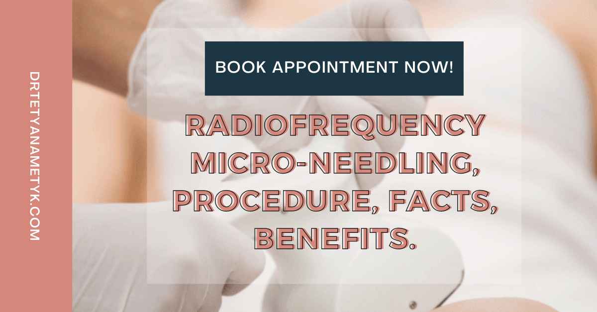 Radiofrequency Micro Needling, Procedure, Facts, Benefits